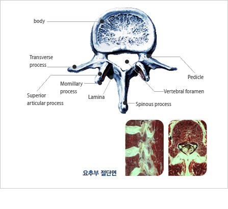 요추부절단면 사진